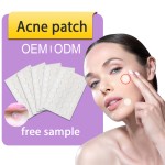 Hydrocolloid Acne Patch Supplier - Skin Care Salicylic Acid Tea Tree Oil Customized
