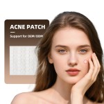 Acne Sticker Supplier - OEM Invisible Hydrocolloid Private Label Cover Patch