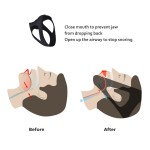 Anti Snoring Belt Supplier - Chin Strap Mouth Guard Bandage