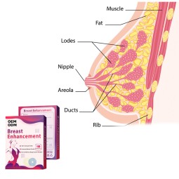 Breast Enlargement Patches Factory - Female Healthcare Natural Herbal Care Enhancement