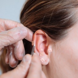 Magnetic Ear Acupuncture Patch Manufacturer - Customizable Natural Herbs Hypoallergenic