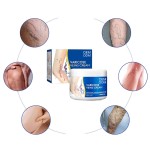 Varicose Vein Cream Factory - New Effective Herbal Ointment Vasculitis Treatment