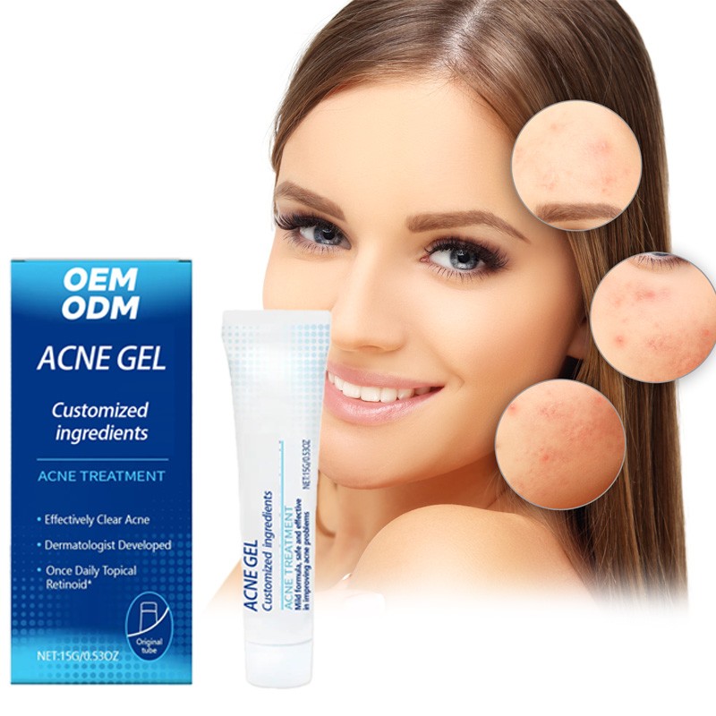 Anti-Acne Face Gel Factory - Safe Herbal Blackhead Remover Repair Cleaning All Skin