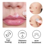 Ultra-Thin Acne Patch Manufacturer - Rapid Pimple Blemish Relief Clear Dots Dermatologist