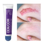 Scar Gel Manufacturer - OEM Customizable Advanced for Old New Scars Healthcare