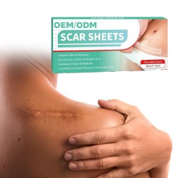 Silicone Scar Sheet Manufacturer - Self-Adhesive Gel Patch Healthcare Scar Removal