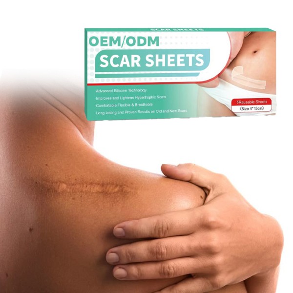 Silicone Scar Sheet Manufacturer - Self-Adhesive Gel Patch Healthcare Scar Removal