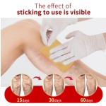 Varicose Pain Plasters Supplier - Herbal for Beauty Varicose Relief Earthworm Legs