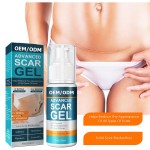 Acne Scar Removal Cream Manufacturer - Fastest Gel for Bruises Repair Tummy Tightening