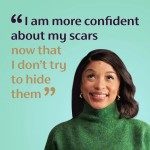 Scar Gel Manufacturer - OEM Customizable Advanced for Old New Scars Healthcare