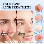 Hydrocolloid Acne Patch Factory - Custom Star Shape Colorful Private Label Mouth