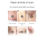 Silicone Scar Gel Factory - for Stretch Marks Acne Scar Treatment Surgical Burns