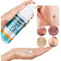 Scar Remover Cream Factory - Hot Sales Online Home Use Effective Old New Scars