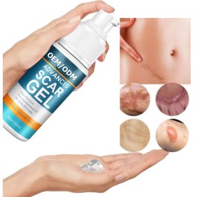 Scar Remover Cream Factory - Hot Sales Online Home Use Effective Old New Scars