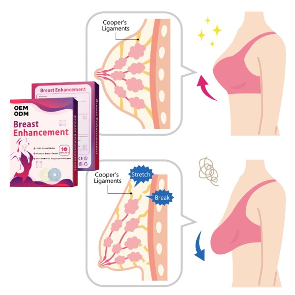 Breast Enhancer Patch Manufacturer - OEM ODM Upright Lifter Firming Sagging Improvement