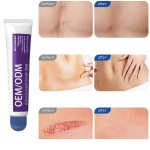 Scar Gel Supplier - Advanced for Beauty Healthcare Treats Old New Scars Reduces