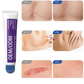 Scar Gel Supplier - Advanced for Beauty Healthcare Treats Old New Scars Reduces