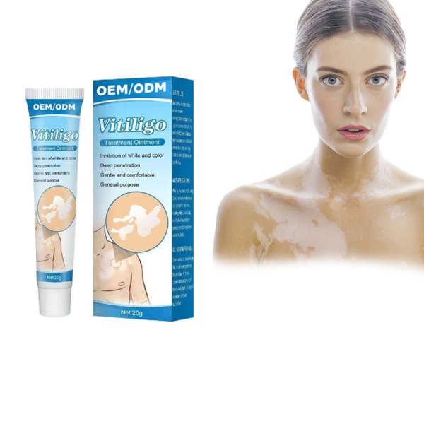 Psoriasis Ointment Manufacturer - 2025 Direct Factory Skin Repair Vitiligo Treatment