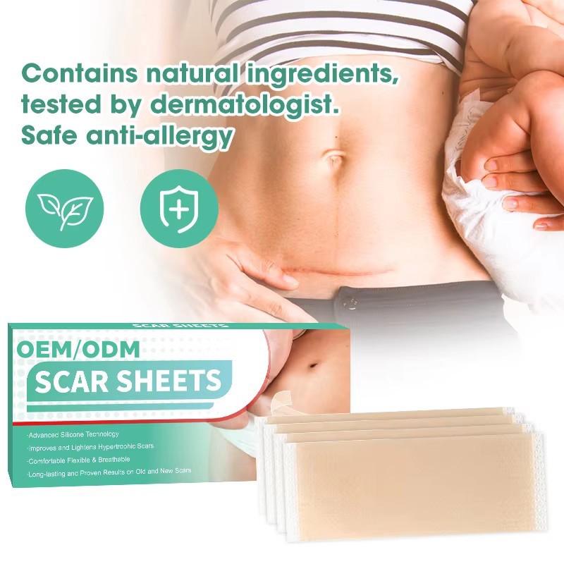 Scar Gel Sheet Factory - Customizable Size Color CE/ISO Certified Scar Removal