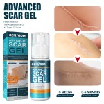 Acne Scar Removal Cream Manufacturer - Fastest Gel for Bruises Repair Tummy Tightening
