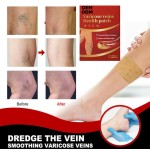 Varicose Pain Plasters Supplier - Herbal for Beauty Varicose Relief Earthworm Legs