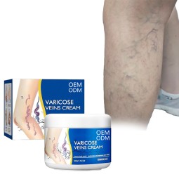 Vein Soothing Ointment Manufacturer - Intravenous Healthcare Eliminating Varicose Veins