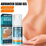 Skin Care Scar Gel Supplier - Private Label Home Use Fade Marks Regeneration Removal