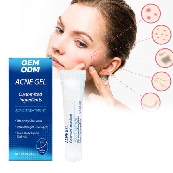 Skin Repair Cream Supplier - for Acne Scars Stretch Marks Pore Shrinking Blackhead