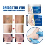 Vein Soothing Ointment Manufacturer - Intravenous Healthcare Eliminating Varicose Veins