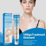 Psoriasis Ointment Manufacturer - 2025 Direct Factory Skin Repair Vitiligo Treatment