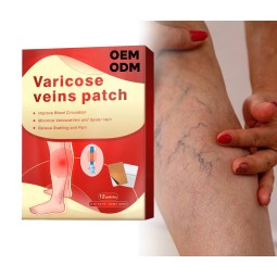 Varicose Veins Supplement Supplier - Factory Priced Herbal Improves Leg Appearance