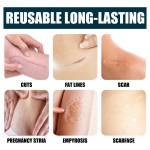 Scar Gels Supplier - Wholesale for Beauty Lightening Acne Marks Surgical Scars