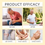 Bee Venom Cream Manufacturer - ENWEI Advanced Bone Healing Moisturizer Anti-Wrinkle