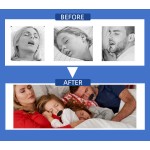 Kinesiology Mouth Patches Factory - Hot Sale Anti-Snoring Sleep Strips Nasal Relief