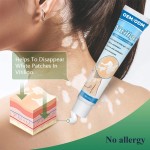 Psoriasis Ointment Manufacturer - 2025 Direct Factory Skin Repair Vitiligo Treatment