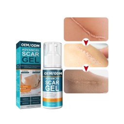 Scar Gels Supplier - Wholesale for Beauty Lightening Acne Marks Surgical Scars