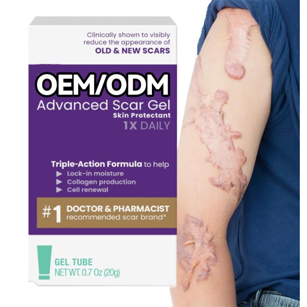 Stretch Mark Cream Manufacturer - Hot Sale ODM OEM Fast-Absorbing Fade Scar Gel