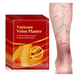 Varicose Pain Plasters Supplier - Herbal for Beauty Varicose Relief Earthworm Legs