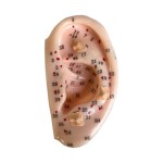 Ear Seeds Supplier - Vaccaria 600 Counts Acupressure Kit