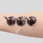 Moxibustion Patch Supplier - Self-stick Mini Moxa Meridian