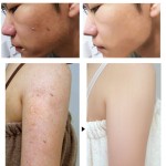 Coconut Soap Factory - Body Wash Scrub Cleansing OEM