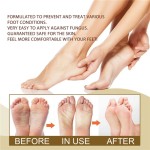 Foot Spray Factory - Anti Fungal Herbal Exfoliating 30ML