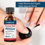 Nail Treatment Oil Factory - Herbal Anti Fungal Renew Formula