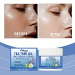 Tea Tree Cream Manufacturer - Natural Anti Fungal Exfoliating