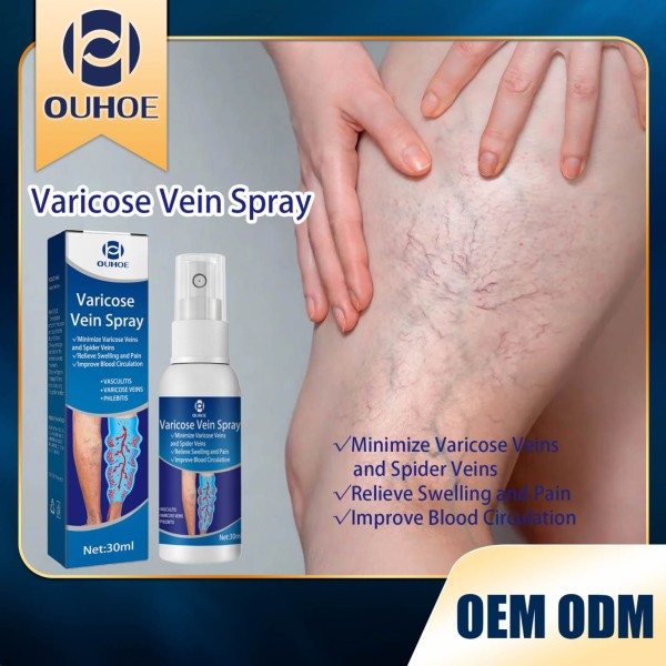 Varicose Veins Spray Supplier - Improve Blood Circulation