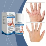 Magnesium Cream Manufacturer - Soothing Redness Itching Care