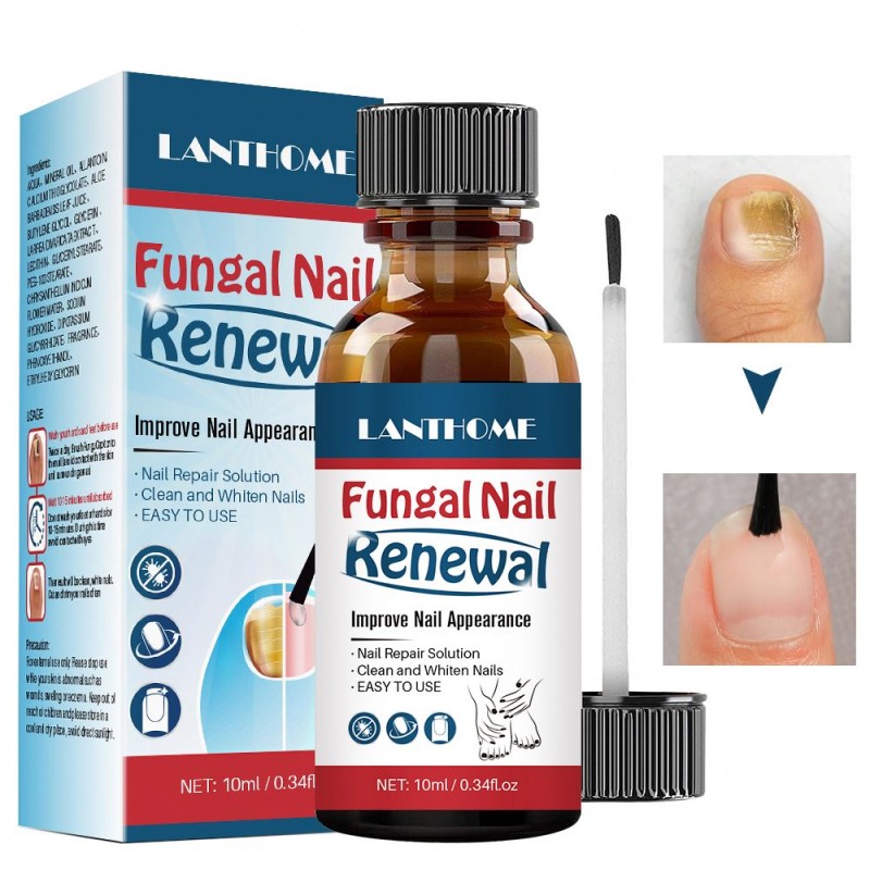 Nail Treatment Oil Factory - Herbal Anti Fungal Renew Formula