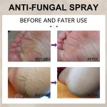 Foot Spray Factory - Anti Fungal Herbal Exfoliating 30ML