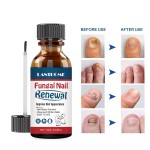 Nail Treatment Oil Factory - Herbal Anti Fungal Renew Formula
