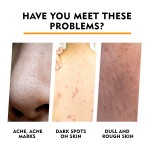 Turmeric Soap Manufacturer - Kojic Acid Skin Brightening Handmade